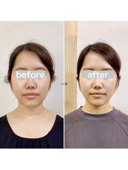 横浜DRT矯正院/小顔・美顔矯正