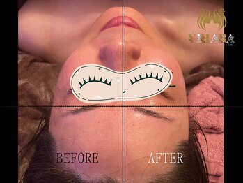 ビハーラ 門司店/リフトアップ