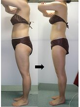 心 美 凛 双葉店/ビフォーアフター