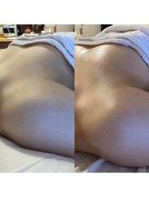 ララルアナ(Lara luana)/横になっても流れない美バスト