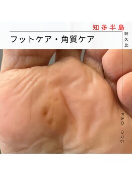 ピーアンドオー(P&O)/
