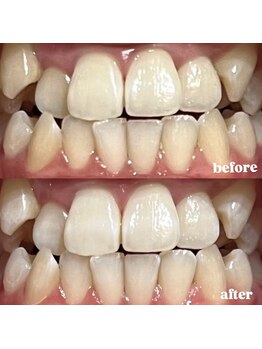 四国健康村 宇多津店/Before After