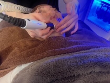 アエル(Aelu)の写真