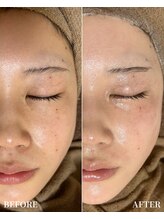 エース(ACE.)/気になる【くすみ・毛穴】を改善