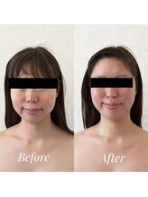 ワン(One)/10名様限定撮影モニター