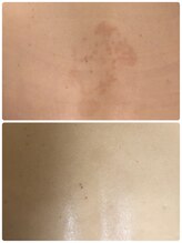 オアジスパ(Oasi Spa)/ＤＴありハーブ５回