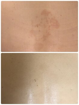 オアジスパ(Oasi Spa)/ＤＴありハーブ５回