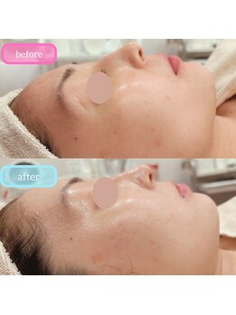 ベルチェリカ(Belle CHERIKA)/ララピールツヤ毛穴レス肌爆誕!