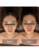 グレースフィオーレ 豊田店(gracefiore)/ビフォーアフター