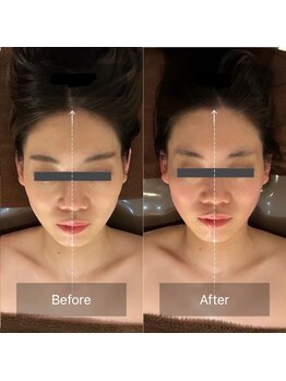 グレースフィオーレ 豊田店(gracefiore)/ビフォーアフター