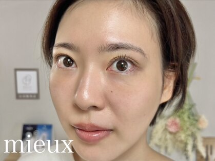 ミュー(mieux)の写真