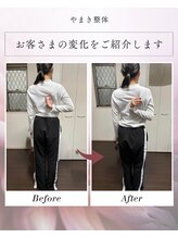 やまき整体/肩甲骨を天使の羽に。