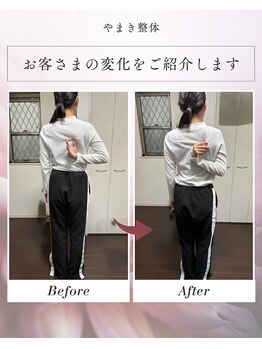 やまき整体/肩甲骨を天使の羽に。