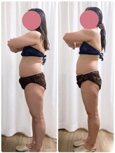 ミロク(369)/脂肪冷却痩身　20カップ終了