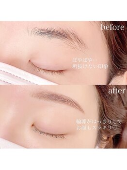 アイウェーブ(Eye wave)/マップブローワックス