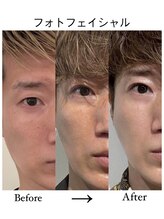 コルミチョン サロン(骨美整 salon)/メンズ美容　フォト