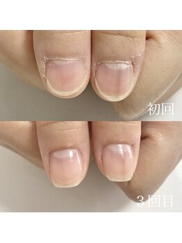 クレア(clea)/ネイルケア【浜松/ネイル】