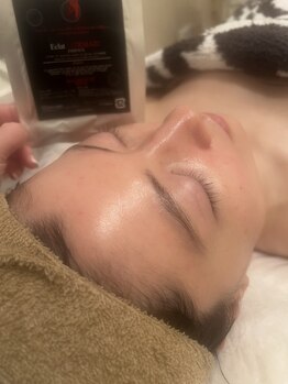 ナチュラドール(NATURADORm)の写真/シミの改善、ニキビケアに！加工無しでもキレイで美しい素肌へ変わる！本格施術で若々しい見た目に★