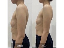 ヴィノ(VINNO)/バストアップへの一番の近道！