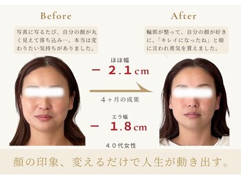 アロハ(ALOHA.)/印象美、変えるだけで人生が変化