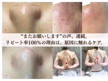 オトサロン(Otosalon)の雰囲気（巻き肩猫背でお悩みの方★普通の整体マッサージとは違う効果を★）