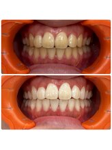 コナホワイトニング 神保町/ホワイトニング神保町