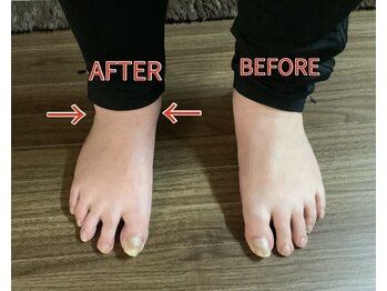 ヨサパーク ヴィヴァン(YOSAPARK Vivant)/たった3分の足湯でむくみが！