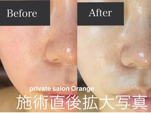 オレンジ(Orange)/プラズマ導入before after
