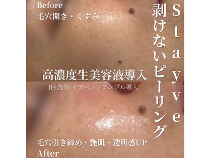 ポプリ(potpourri)の写真