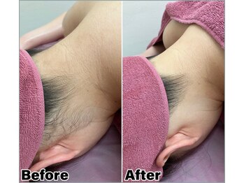 ベルミーランド MEGAドン・キホーテ草加/えり足Before→After