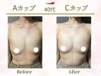 Ms.やまとなでしこ/【ビフォーアフター】A→Cカップ