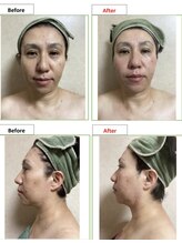 エステティック レイビス 銀座店(RAYVIS)/