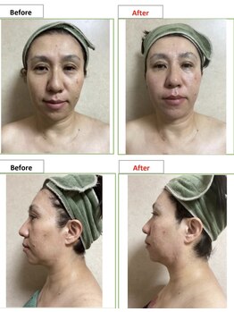 エステティック レイビス 銀座店(RAYVIS)/