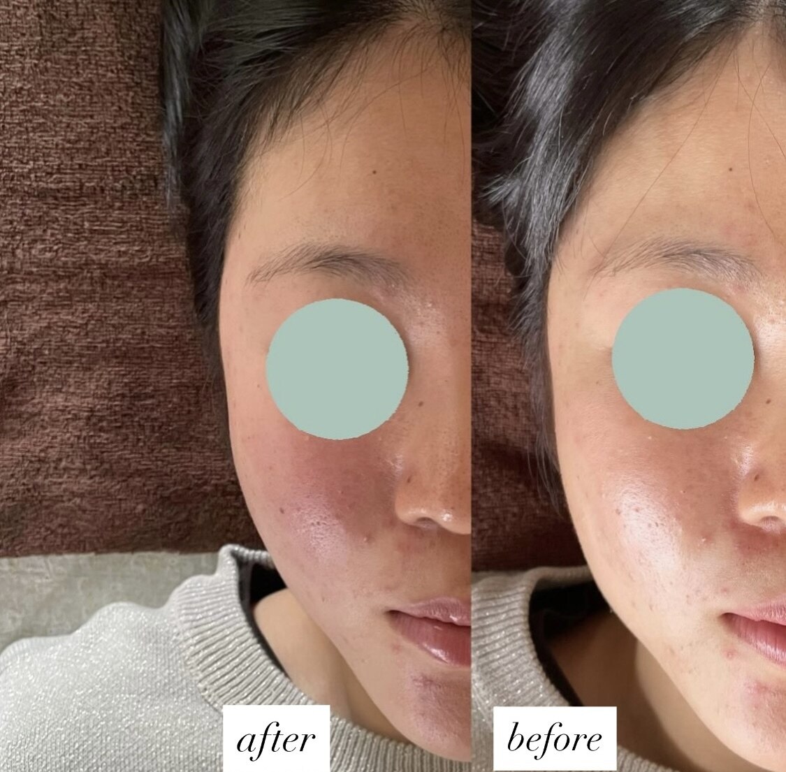 金沢市でクラニオパシー・頭蓋骨矯正がおすすめのサロン