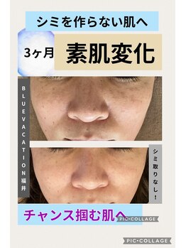 ブルーバケーション(Blue Vacation)/