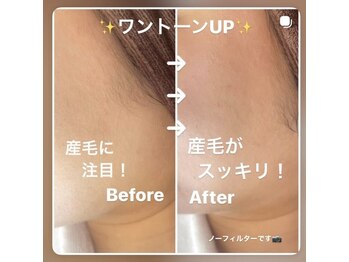 カランコエ(Kalanchoe)/フェイシャルWax