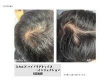 トータルクリア(TOTAL CLEAR)/スカルプケア