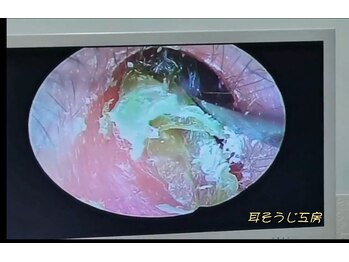 健工房 鴨宮店/耳かきしながら、疲れを解消する