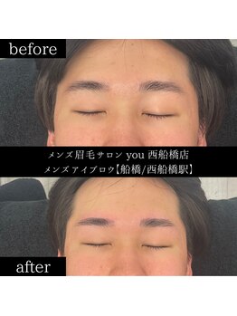 ユー 西船橋店(you)/ビフォーアフターお写真