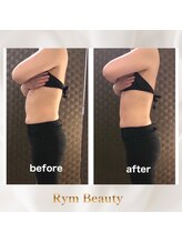 リム ビューティー(RYM BEAUTY)/最新超音波×インディバ