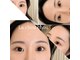 ラシュシュ(la chou chou)の写真