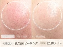 キヌ(KINU)