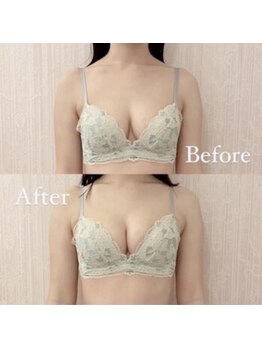 ベルファム(BelleFemme)の写真/【駅徒歩3分/20時迄営業】左右差や離れ気味など…バストのお悩み何でもご相談下さい◎理想の谷間叶えます♪