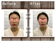 アゴラ/【小顔】中国のイベント会場にて