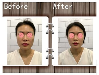 アゴラ/【小顔】中国のイベント会場にて