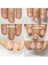 ニコプラス(NICO+)/自爪育成中