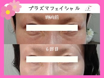 ソーハート(So Heart)/☆大人気！エイジングケアに特化