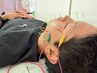男性向け美容鍼　「若く見られる男の、秘密の習慣」