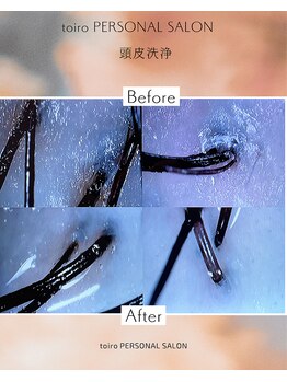 トイロ(toiro)/頭皮洗浄