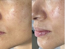 ベルード(veludo)/